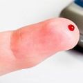 FDA       (HCV)