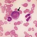 Sapacitabine -    