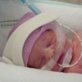      CPAP  