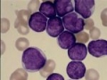   Temozolomide         