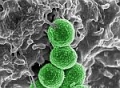   Ceftobiprole     ,   -   S. Aureus.