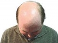  - , ,   