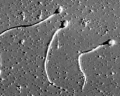 Sildenafil ,  Tadalafil    