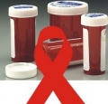     HIV