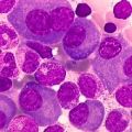 Lenalidomide      