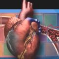    clopidogrel  