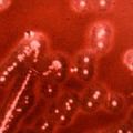 Amoxicillin        