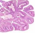          cidofovir