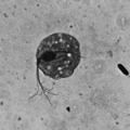   Trichomonas vaginalis          