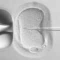 Шест зрели ооцита са оптималният вариант за постигане на живо раждане чрез асистирана репродуктивна техника