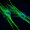 Стволови клетки възстановяват яйчниковата функция