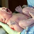 Забавеното клампиране на пъпната връв увеличава железните запаси на бебето