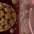 HPV предизвиква бавна епидемия от рак на устната кухина
