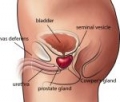 Простатата. Подходяща диета и хранителни добавки