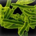 Латентната туберкулоза предпазва от активно заболяване