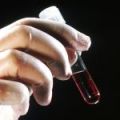 Скоро кръвен тест ще може да прогнозира разкъсването на атеросклеротичните плаки